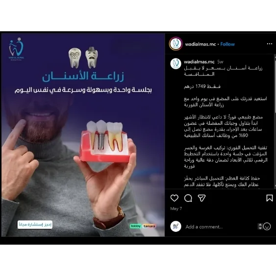 كرييتف زراعة الأسنان وادي الماس